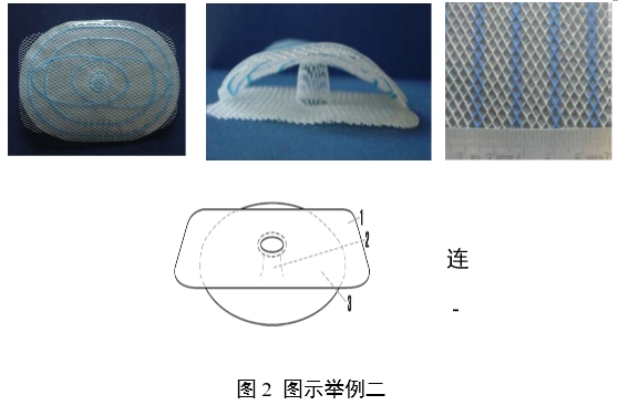 疝修補補片注冊審查指導(dǎo)原則（2023年修訂版）（2023年第9號）(圖5)